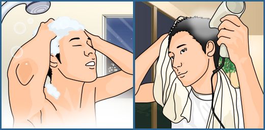 【医師が解説】頭皮の炎症による薄毛への対策の画像