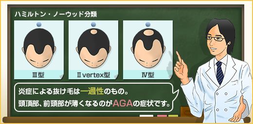 【医師が解説】毛染めによる抜け毛とAGAの因果関係の画像