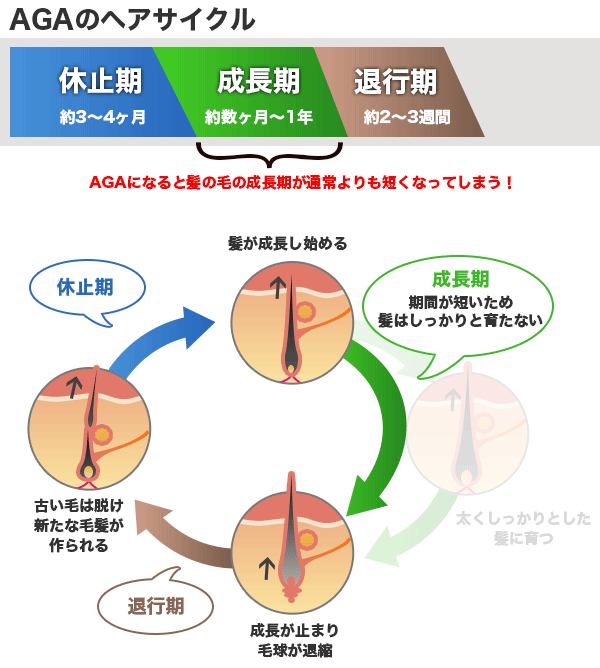 AGAのヘアサイクル