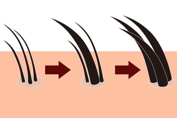 育毛剤の効果イメージ