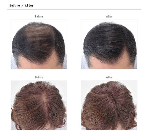 スーパーミリオンヘアの使用前使用後画像